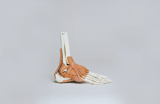 8 Ways to Prevent Bunions