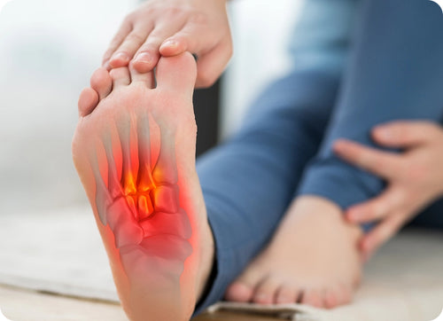 Plantar Fasciitis